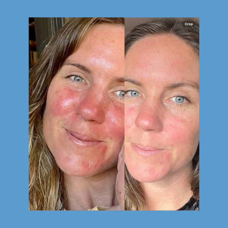 Side-by-side comparison of a woman&