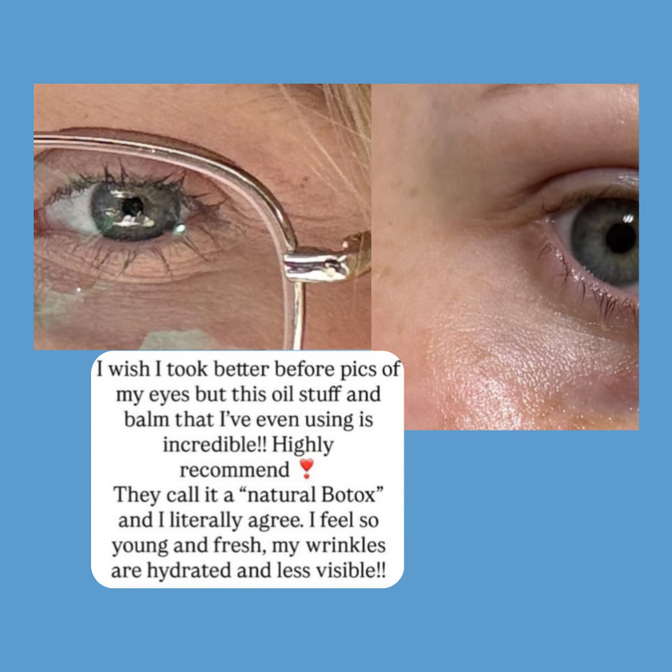 Close-up of eyes with text about eye balm product effectiveness