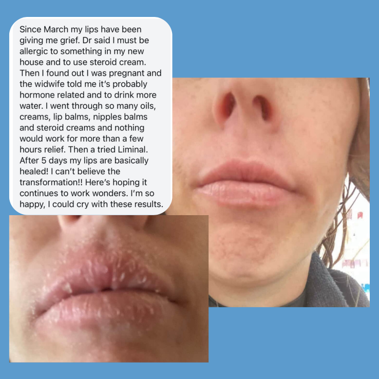Before and after comparison of lips with text about lip care journey using Liminal Face Balm