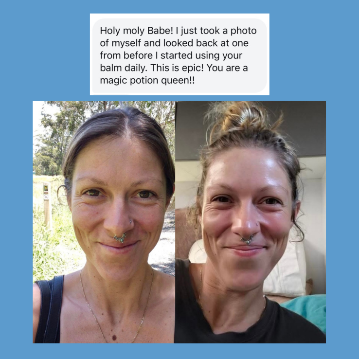 Before and after comparison of a woman&