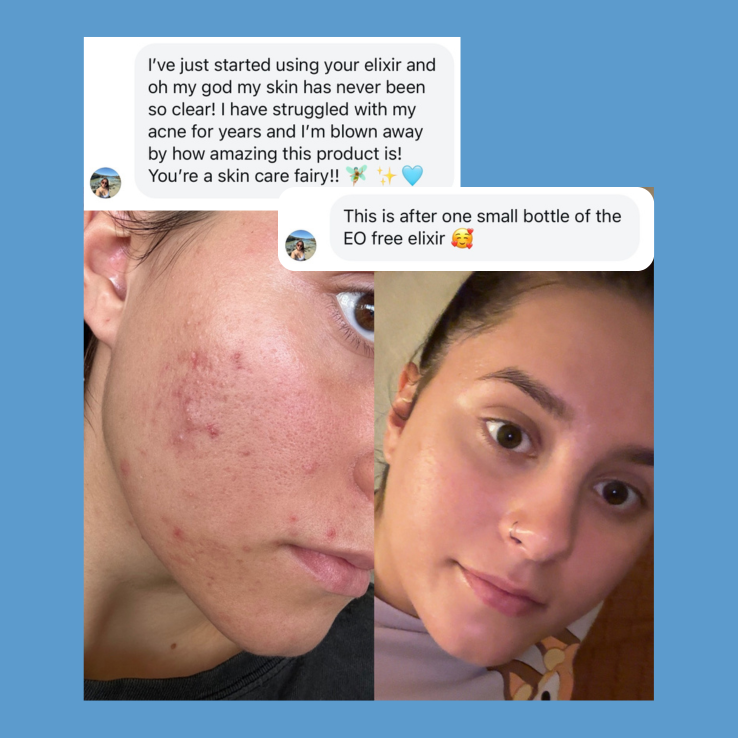 Sensitive Facial Elixir